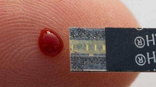 New Advanced Prostate Cancer Blood Test